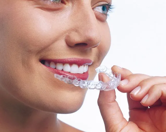 Woman inserting clear dental aligner, Australian dental health